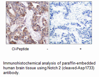 Product image for Notch 2 (Cleaved-Asp1733) Antibody