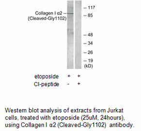 Product image for Collagen I &alpha;2 (Cleaved-Gly1102) Antibody