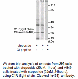 Product image for C1R (light chain,Cleaved-Ile464) Antibody