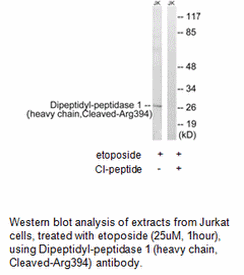 Product image for Dipeptidyl-peptidase 1 (heavy chain,Cleaved-Arg394) Antibody