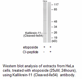 Product image for Kallikrein-11 (Cleaved-Ile54) Antibody