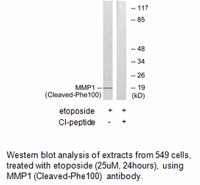 Product image for MMP1 (Cleaved-Phe100) Antibody