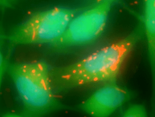 Phagocytosis of bacteria by Hela Cells