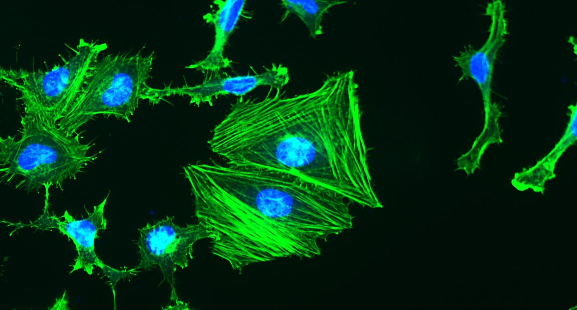 Fluorescence image of HeLa cells stained with Actin Lightning™ iFluor® 488 Phalloidin Conjugate and Nuclear Blue™ DCS1. Cells were fixed with 4% formaldehyde, permeabilized with 0.2% Triton™ X-100, then stained with Actin Lightning™ iFluor® 488 Phalloidin Conjugate (Cat. #22710) for F-actin detection and counterstained with Nuclear Blue™ DCS1 (Cat. #17548). Images were acquired using FITC and DAPI filter sets and overlaid to show F-actin in green and nuclei in blue.