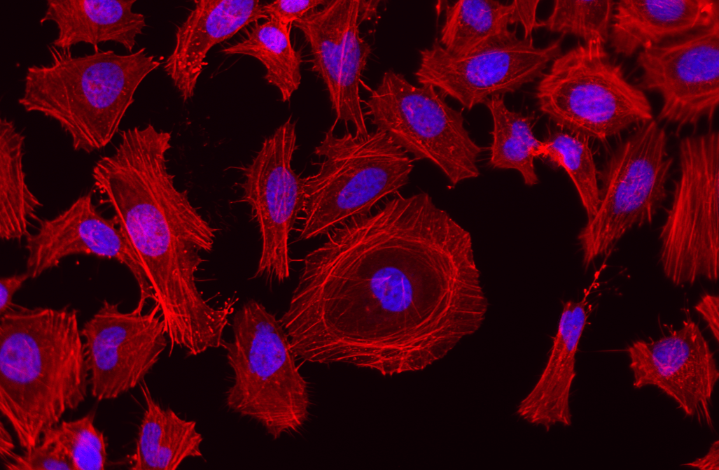 Fluorescence image of HeLa cells stained with Actin Lightning™ iFluor® 570 Phalloidin Conjugate and Nuclear Blue™ DCS1. Cells were fixed with 4% formaldehyde, permeabilized with 0.2% Triton™ X-100, then stained with Actin Lightning™ iFluor® 570 Phalloidin Conjugate (Cat. #22716) for F-actin detection and counterstained with Nuclear Blue™ DCS1 (Cat. #17548). Images were acquired using Cy3 and DAPI filter sets and overlaid to show F-actin in red and nuclei in blue.