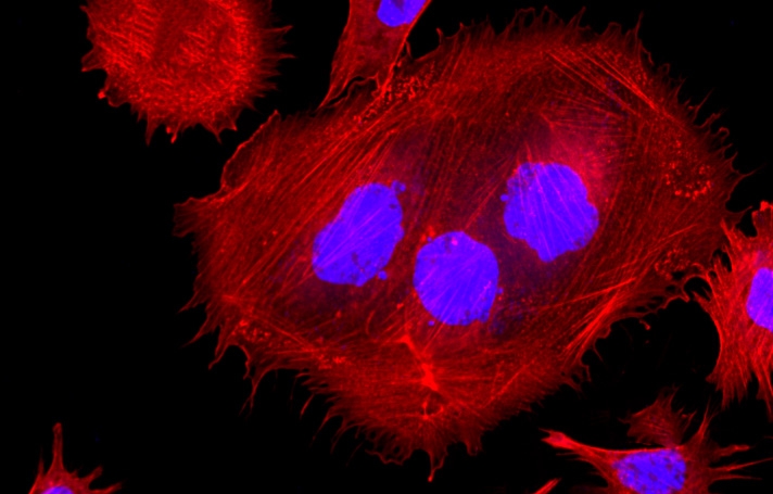 Fluorescence image of CPA 47 cells stained with Actin Lightning™ iFluor® 647 Phalloidin Conjugate and Nuclear Blue™ DCS1. Cells were fixed with 4% formaldehyde, permeabilized with 0.2% Triton™ X-100, then stained with Actin Lightning™ iFluor® 647 Phalloidin Conjugate (Cat. #22719) for F-actin detection and counterstained with Nuclear Blue™ DCS1 (Cat. #17548). Images were acquired using Cy5 and DAPI filter sets and overlaid to show F-actin in red and nuclei in blue.