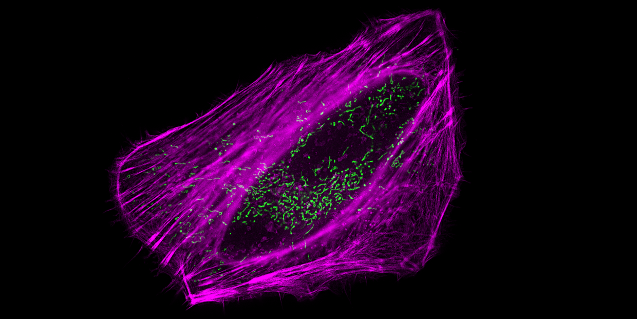 Super-resolution fluorescence image of live HeLa cells stained with Actin Lightning™ LC Red and MitoLite™ Green FM. Live HeLa cells were labeled with Actin Lightning™ LC Red (Cat. #22705) for F-actin staining and MitoLite™ Green FM (Cat. #22695) for mitochondrial staining. Images were acquired on the CSR Biotech MI-SIM microscopy system and reconstructed using 3D-SIM Wiener reconstruction. The merged image shows F-actin in magenta and mitochondria in green.
Image credit: Images were generated by CSR Biotech on their MI-SIM microscopy system using Actin Lightning™ LC Red and MitoLite™ Green FM from AAT Bioquest.