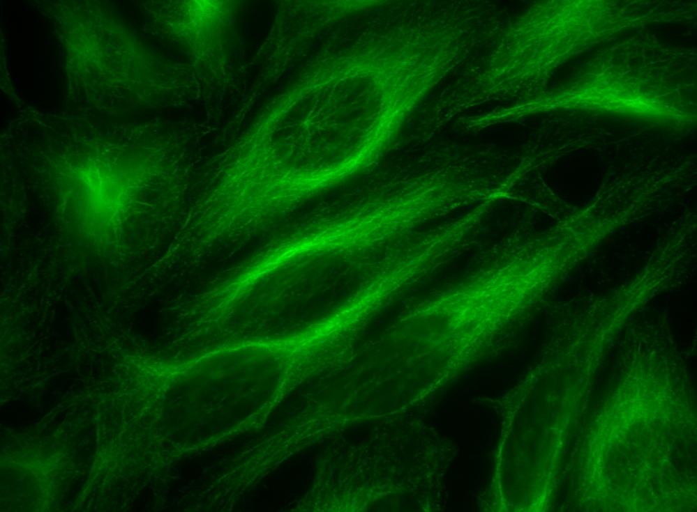 HeLa cells were incubated with mouse anti-tubulin followed by AAT&rsquo;s AF488-labeled goat anti-mouse IgG (H+L).