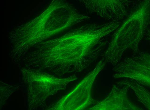 HeLa cells were incubated with rabbit anti-tubulin followed by AAT&rsquo;s AF488-labeled goat anti-rabbit IgG (H+L).