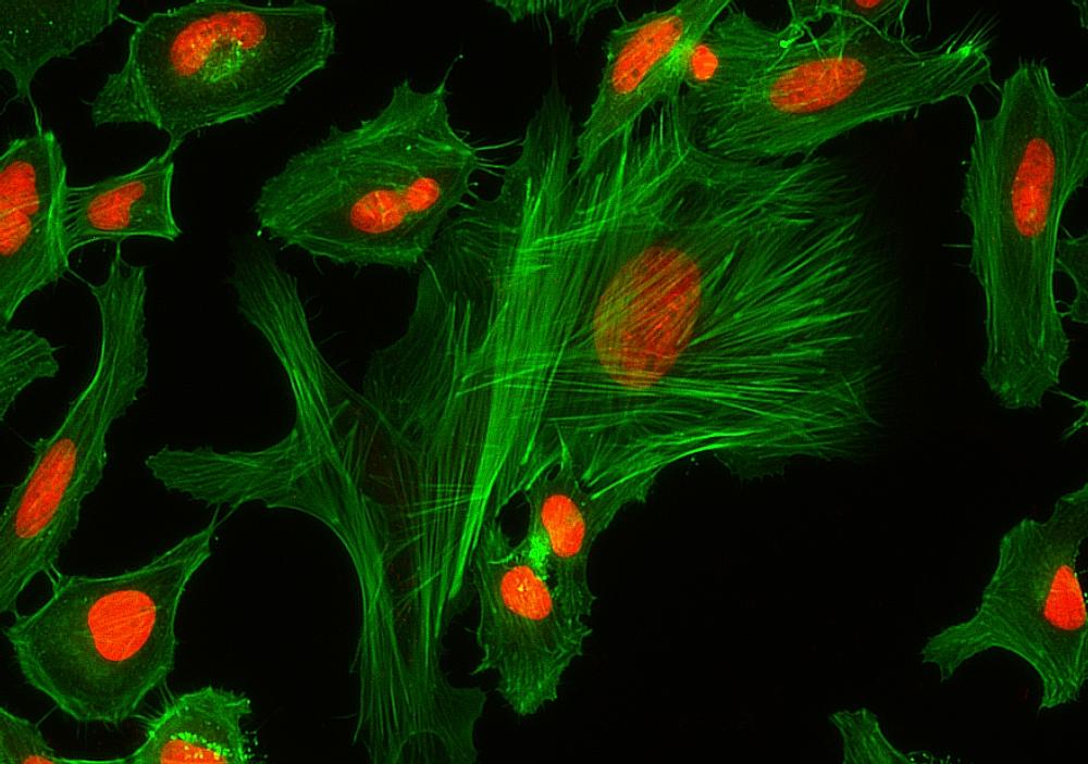 Fluorescence image of HeLa cells fixed with 4% formaldehyde then stained with AF488 Phalloidin (Cat#23153, Green) and nuclei stain Nuclear Red&trade; DCS1 (Cat#17552, Red), respectively. &nbsp;
