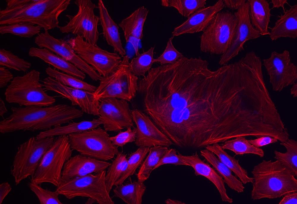 Fluorescence image of HeLa cells fixed with 4% formaldehyde then stained with AF594 Phalloidin (Cat#23158, Red) and nuclei stain Nuclear Blue&trade; DCS1 (Cat#17548, Blue), respectively. &nbsp;