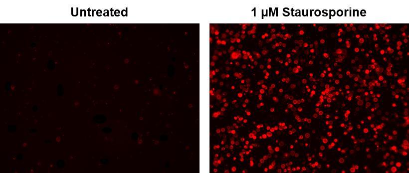 Fluorescence image of Jurkat cells stained with TRITC-Annexin V. Jurkat cells were treated without (Left) or with 1 &mu;M staurosporine (Right) in 37 &ordm;C for 4 hours. The fluorescence intensity was measured using a fluorescence microscope with TRITC filter set.