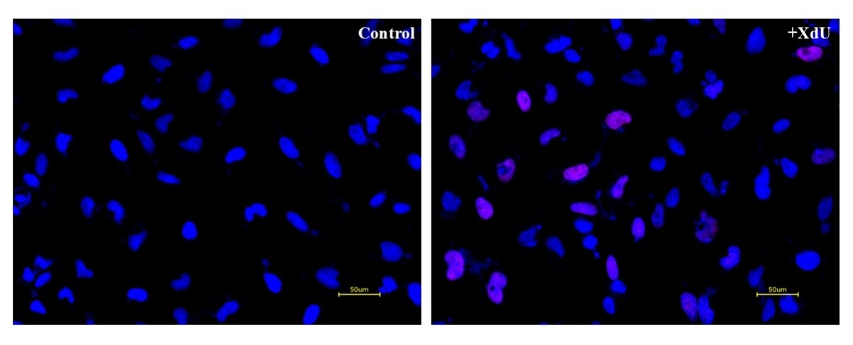 S-phase HeLa cells detection using the Bucculite™ XdU Cell Proliferation Fluorescence Imaging Kit. HeLa cells (50,000 cells/well in 100 µL) were seeded overnight in a 96-well black wall/clear bottom plate. Cells were treated with XdU at 37°C for 3 hours, then fixed with Methanol/PBS (90/10). After fixation, cells were stained with iFluor® 555-MTA for 30 minutes in staining buffer, followed by three washes with 1X Washing Buffer. Nuclear staining was performed with 100 µL of 5 µg/mL Hoechst 33342 solution in 1X Washing Buffer. Fluorescence images were acquired using a TRITC filter to visualize S-phase cells (red) and a DAPI filter for nuclear staining (blue).