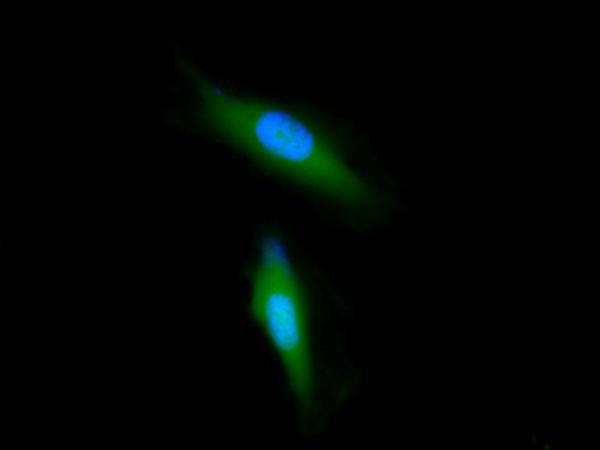 Images of Live HeLa cells stained with Calcein, AM (Cat.22002). Cell nuclei were stained with Hoechst 33342 (Blue, Cat#17535).