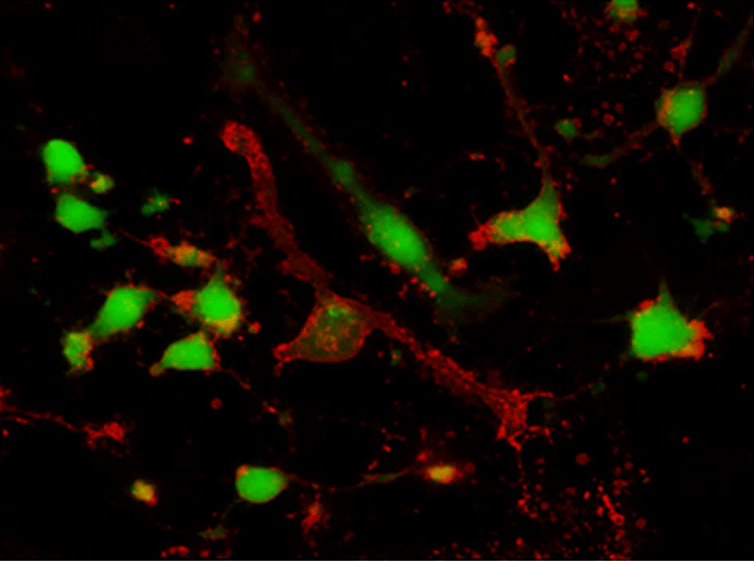 Simultaneous imaging of live and apoptotic HeLa cells labeled using calcein AM (Cat No. 22002) and Annexin V-iFluor® 647 conjugate (Cat No. 20074).