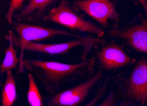 Image of Live HeLa cells stained with Calcein Orange™ diacetate (Cat#22009). Cell nuclei were stained with Hoechst 33342 (Blue, Cat#17535).<br /> <br /> 