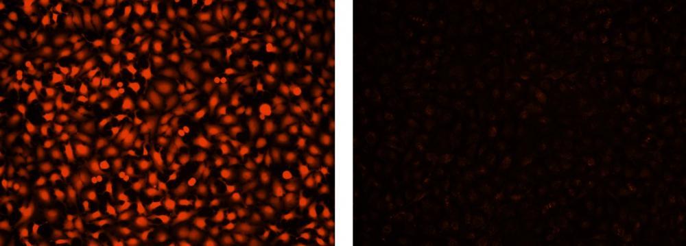 Images of HeLa cells stained with Calcein Red&trade; AM. Left: Live HeLa cells; Right: Fixed HeLa cells.