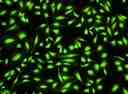 Image of HeLa cells stained with Cell Explorer&trade; Live Cell Tracking Kit in a Costar black wall/clear bottom 96-well plate. Cells were stained with&nbsp;Track It&trade; Green (Cat#22621) and incubated for 15 minutes. Images were aquired using fluorescence microscope with FITC filter set.