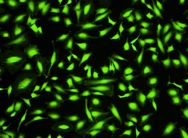 Image of HeLa cells stained with Cell Explorer™ Live Cell Tracking Kit in a Costar black wall/clear bottom 96-well plate. Cells were stained with Track It™ Green (Cat#22621) and incubated for 15 minutes. Images were aquired using fluorescence microscope with FITC filter set.