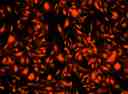 Image of HeLa cells stained with Cell Explorer&trade; Live Cell Tracking Kit in a Costar black wall/clear bottom 96-well plate. Cells were stained with&nbsp;Track It&trade;&nbsp;Red (Cat#22625) and images were aquired using fluorescence microscope with Texas Red filter&nbsp;set.