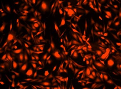 Image of HeLa cells stained with Cell Explorer™ Live Cell Tracking Kit in a Costar black wall/clear bottom 96-well plate. Cells were stained with Track It™ Red (Cat#22625) and images were aquired using fluorescence microscope with Texas Red filter set.