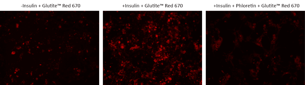 Fluorescence images of Glutite™ Red 670 uptake in differentiated 3T3-L1adipocytes using Cell Meter™ Glucose Uptake Imaging Kit. Differentiated 3T3-L1 cells at 50,000 cells/wells/100 µL were seeded overnight in a 96-well Poly-D-Lysine black wall/clear bottom plate. The cells were pre-treated with insulin for 2 hours before being treated with Glutite™ Red 670 and phloretin for 60 minutes. The images were acquired using a fluorescence microscope with a Cy5 filter set.