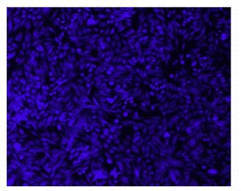 Image of CPA cells in 96-well Costar black wall/clear bottom plate stained with Cell Explorer™ Live Cell Labeling Kit *Blue Fluorescence with 405 nm Excitation*(Cat#22614). Cells were stained with CytoCalcein™ Violet 450 for 30 minutes. Images were aquired using fluorescence microscope using DAPI filter.