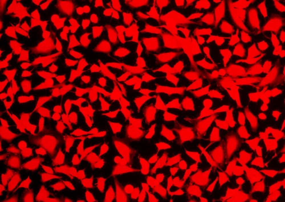 Image of HeLa cells stained with Cell Explorer™ Live Cell Labeling Kit *Red Fluorescence* (Cat#22609)in a Costar black wall/clear bottom 96-well plate. Cells were stained with Calcein Red™ for 30 minutes and image was aquired with fluorescence microscope using Cy5 filter.