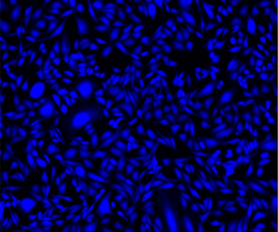 Image of HeLa cells stained with Cell Explorer&trade; Live Cell Tracking Kit (Cat#22620) in a Costar black wall/clear bottom 96-well plate. Cells were stained with&nbsp;Track It&trade; Blue for 15 minutes and image was aquired with fluorescence microscope using DAPI filter.