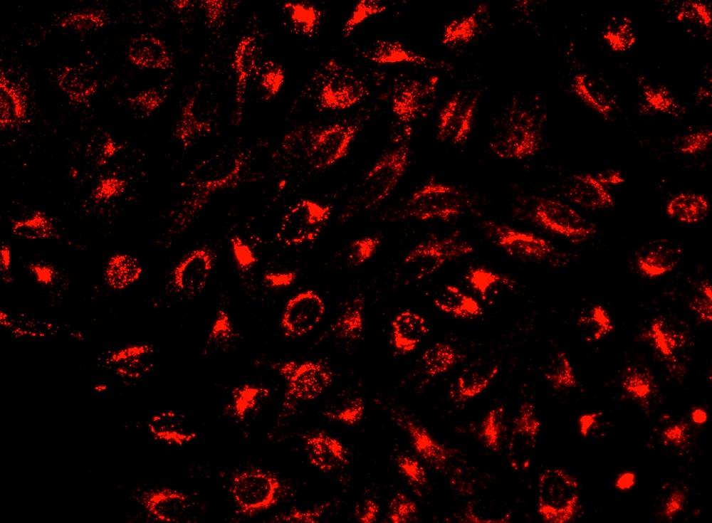 Image of HeLa cells stained with Cell Explorer&trade; Live Cell Tracking Kit&nbsp;(Cat#22624)in a Costar black wall/clear bottom 96-well plate. Cells were stained with&nbsp;Track It&trade; Deep Red for 15 minutes and image was aquired with fluorescence microscope using Cy5 filter.