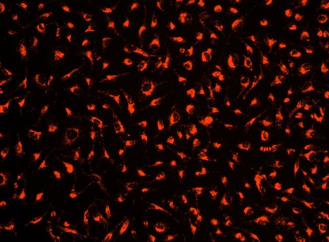 Image of HeLa cells stained with Cell Explorer&trade; Live Cell Tracking Kit *Red Fluorescence* (Cat#22623) in a Costar black wall/clear bottom 96-well plate. Cells were stained with Track<sup>TM</sup> It Red solution and image was aquired using fluorescence microscope.