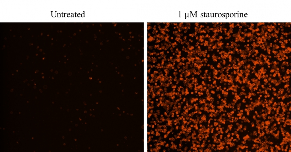 Images of Jurkat cells in a Costar black wall/clear bottom 96-well plate stained with Cell Meter Annexin V Binding Apoptosis Assay Kit *Orange Fluorescence*. (Left): Untreated control cells. (Right): Cells treated with 1 μM staurosporine for 5 hours.