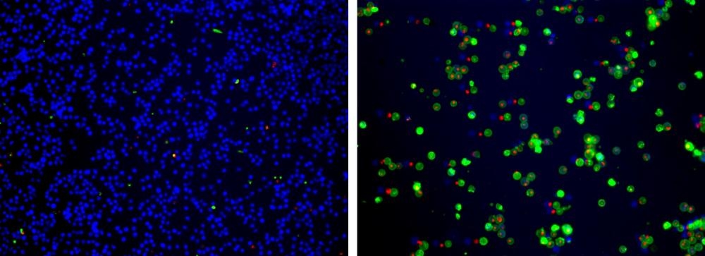 The fluorescence images showing cells that are live (blue, stained by CytoCalcein™ Violet 450), apoptotic (green, stained by Apopxin™ Green), and necrotic (red, indicated by 7-AAD staining) in Jurkat cells induced by 1µM staurosporine for 3 hours. The fluorescence images of the cells were taken with Olympus fluorescence microscope through the Violet, FITC and Texas Red channel respectively. Individual images taken from each channel from the same cell population were merged as shown above. Left: Non-induced control cells; Right: Triple staining of staurosporine-induced cells.