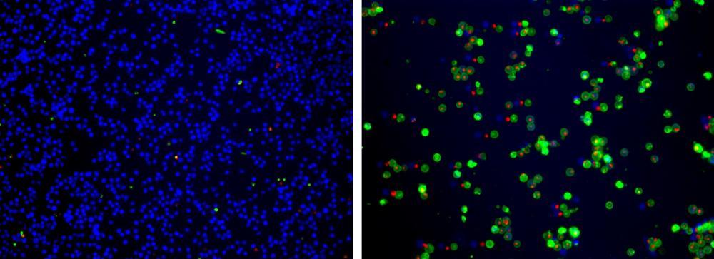 The fluorescence images showing cells that are live (blue, stained by CytoCalcein™ Violet 450), apoptotic (green, stained by Apopxin™ Green), and necrotic (red, indicated by 7-AAD staining) in Jurkat cells induced by 1µM staurosporine for 3 hours. The fluorescence images of the cells were taken with Olympus fluorescence microscope through the Violet, FITC and Texas Red channel respectively. Individual images taken from each channel from the same cell population were merged as shown above. Left: Non-induced control cells; Right: Triple staining of staurosporine-induced cells.