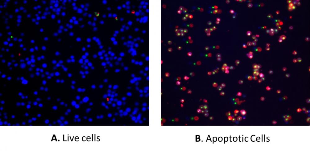 The detection of binding activity of Apopxin&trade; Deep Red to phosphatidylserine in Jurkat cells using Cell Meter&trade; Apoptotic and Necrotic Mulptiplexing Detection Kit II. The fluorescence images showing cells that are live (blue, stained by CytoCalcein&trade; Violet 450), apoptotic (red, stained by Apopxin&trade; Deep Red), and necrotic (green, indicated by Nuclear Green&trade; DCS1 staining) in Jurkat cells induced by 1 &mu;M staurosporine for 3 hours. The fluorescence images of the cells were taken with Olympus fluorescence microscope through the Violet, Cy5 and FITC channel respectively. Individual images taken from each channel from the same cell population were merged as shown above. A: Non-induced control cells; B: Triple staining of staurosporine-induced cells.
