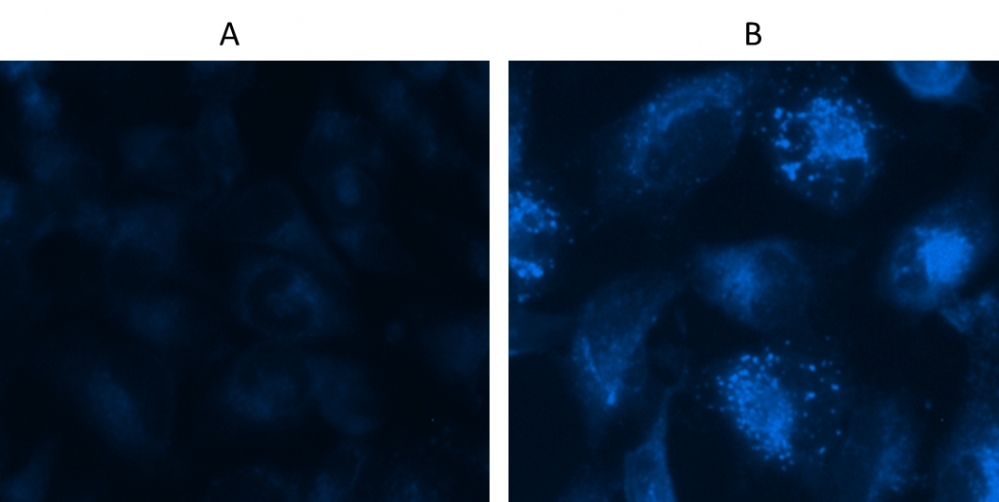 Autophagy Blue™ labeled vesicles are induced by starvation in HeLa cells using Cell Meter™ Autophagy Assay Kit. HeLa cells were incubated in a regular DMEM medium as control (A) or in a serum-depleted medium as autophagy treatment (B) for 16 hours. Both control cells and starved cells were incubated with Autophagy Blue™ working solution for 30 minutes in a 37 °C, 5%  CO<sub>2 </sub>incubator, and then washed four times with wash buffer. Cells were imaged immediately under a fluorescence microscope with a DAPI channel. Autophagy is indicated by bright blue dot staining of autophagic vacuoles (B).