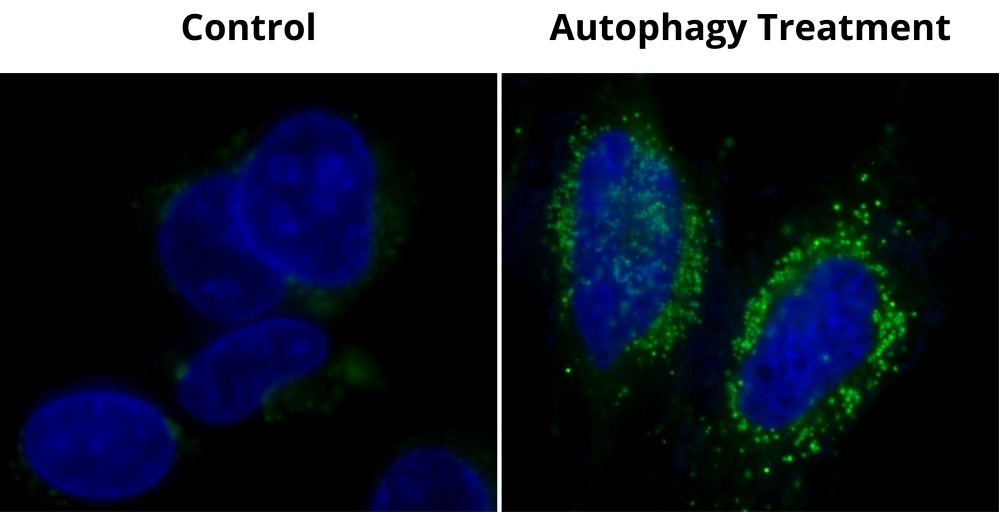 Autophagy Green™ labeled vesicles were induced by starvation in HeLa cells. HeLa cells were incubated in a regular DMEM medium (Left: Control) or in 1X HBSS buffer with 5% serum (Right: Autophagy Treatment) for 16 hours. Both control and starved cells were incubated with Autophagy Green™ working solution for 20 minutes in a 37 °C, 5% CO2 incubator, and then washed 3 times with wash buffer. Cells were imaged immediately under a fluorescence microscope with a FITC channel (green). Cell nuclei were stained with Hoechst 33342 (blue).