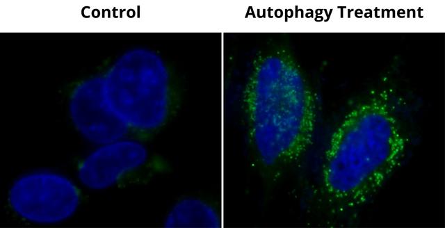 Autophagy Green&trade; labeled vesicles were induced by starvation in HeLa cells. HeLa cells were incubated in a regular DMEM medium (Left: Control) or in 1X HBSS buffer with 5% serum (Right: Autophagy Treatment) for 16 hours. Both control and starved cells were incubated with Autophagy Green&trade; working solution for 20 minutes in a 37 &deg;C, 5% CO2 incubator, and then washed 3 times with wash buffer. Cells were imaged immediately under a fluorescence microscope with a FITC channel (green). Cell nuclei were stained with Hoechst 33342 (blue).