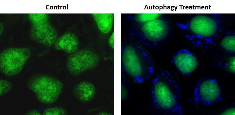 Autophagy Super Blue&trade; labeled vesicles were induced by starvation in HeLa cells. HeLa cells were incubated in a regular DMEM medium (Left: Control) or in 1X HBSS buffer with 5% serum (Right: Autophagy Treatment) for 16 hours. Both control and treated cells were incubated with Autophagy Super Blue&trade; working solution for 20 minutes in a 37 &deg;C, 5% CO2 incubator, and washed 3 times with wash buffer. Cells were imaged immediately under a fluorescence microscope with a DAPI channel (blue). Cell nuclei were stained with Nuclear Green&trade; LCS1 (green).