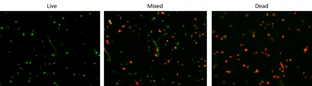 E. coli HST08 stained with Cell Meter™ Bacterial Viability Assay Kit