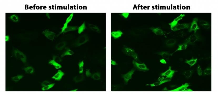 Translocation of beta-arrestin in HeLa cells