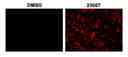Fluorescence images with 9L-LacZ cells. 9L-LacZ cells were stained with Xite&trade; Red beta-D-galactopyranoside directly in cell culture medium 45 mins at 37 &deg;C. The signal was acquired using Cy3/TRITC filter set.