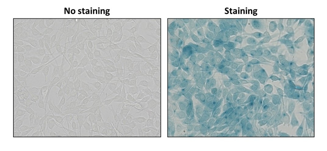 Colorimetric staining of 9L-Lacz (Overexpressed Beta-Gal) cells with Cell Meter™ Colorimetric Cellular Senescence Activity Assay Kit *Blue Color* (Cat# 23009). The colorimetric staining was monitored with light microscopy.