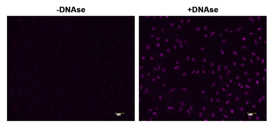 <strong>Fluorescence </strong><strong>images of TUNEL assay </strong><strong>with </strong><strong>HeLa cells. </strong> <br />HeLa cells were fixed and treated with or without DNAse for 60 mins at 37 °C. The cells were then stained with Cell Meter™ Fixed Cell and Tissue TUNEL Apoptosis Assay Kit. DNA strand breaks showed intense fluorescent staining in DNAse treated cells. The signal was acquired with fluorescence microscope using Violet filter set.