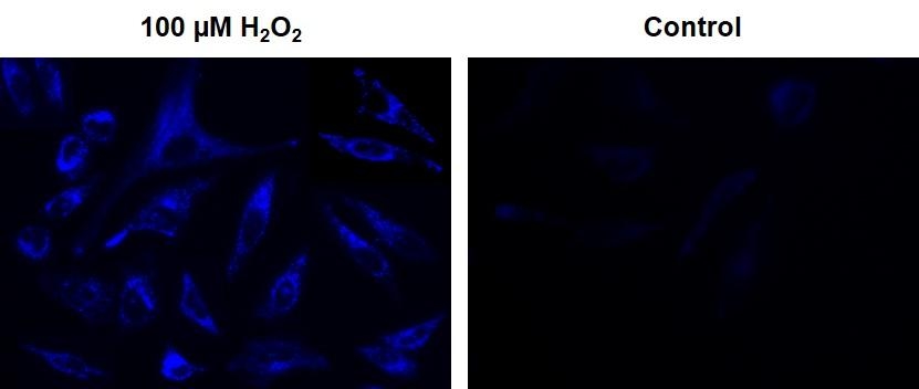 Fluorescence images of intracellular hydrogen peroxide in HeLa cells using Cell Meter™ Intracellular Fluorimetric Hydrogen Peroxide Assay Kit (Cat# 11504). HeLa cells at 10,000 cells/well/100 µL were seeded overnight in a Costar black wall/clear bottom 96-well plate. 100 µM H<sub>2</sub>O<sub>2</sub>: HeLa cells were stained with OxiVision™ Blue peroxide sensor for 30 minutes and treated with 100 µM hydrogen peroxide at 37 °C for 90 minutes. Control: Cells were stained with OxiVision™ Blue peroxide sensor but without hydrogen peroxide treatment. The fluorescence signals were measured using fluorescence microscope with a DAPI filter.