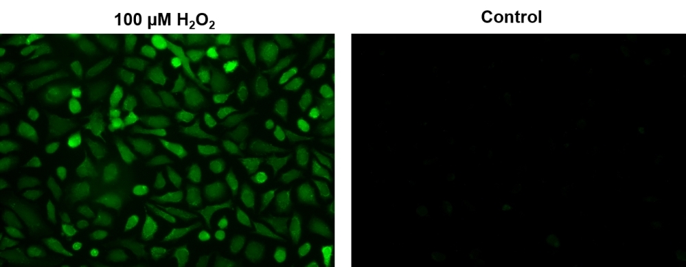 Fluorescence images of intracellular hydrogen peroxide in HeLa cells using Cell Meter™ Intracellular Fluorimetric Hydrogen Peroxide Assay Kit (Cat#11503). HeLa cells were treated with (left) or without (right) 100 µM hydrogen peroxide at 37<sup>o</sup>C for 90 minutes.