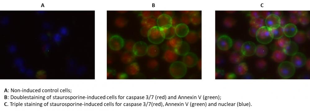 The fluorescence image analysis indicated the increased expression of caspase 3/7 (red, stained by TF3- DEVD-FMK) and Annexin V (Green, stained by Annexin V-iFluor 488™) in Jurkat cells induced by 1 μM staurosporine for 3 hour. The fluorescence images of the cells (300,000 cells/ well) were taken with Olympus fluorescence microscope through the DAPI, FITC, and TRITC channel respectively. Individual images taken from each channel from the same cell population were merged as shown above. A: Non-induced control cells; B: Doublestaining of staurosporine-induced cells for caspase 3/7 (red) and Annexin V (green); C: Triple staining of staurosporine-induced cells for caspase 3/7(red), Annexin V (green) and nuclear (blue).