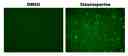 The detection of caspase 3/7 activity in Jurkat cells with Cell Meter™ Live Cell No Wash Caspase 3/7 Imaging Kit. Jurkat cells (200,000 cells/well/96-well plate) were treated with 1 μM staurosporine or DMSO for 4 hours. Cells were incubated with Caspase 3/7 Substrate working solution at 37°C for 1 hour. Images were taken with a fluorescence microscope using a FITC filter set.