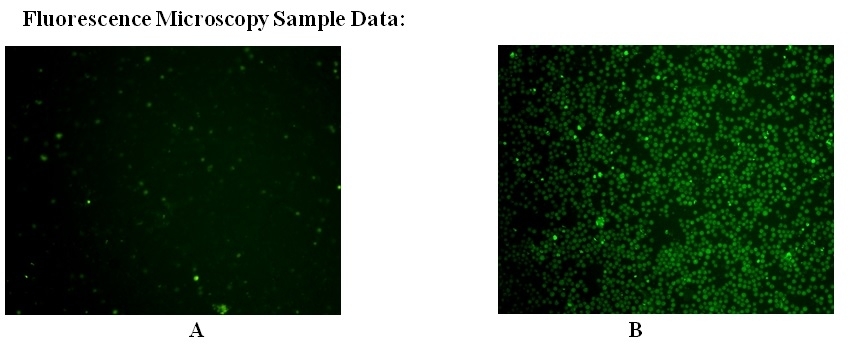 <p>The fluorescent microscopy showing the increase in FAM-LEHD-FMK fluorescence intensity with the addition of 1 μM staurosporin in Jurkat cells. Cells were incubated with FAM-LEHD-FMK for 1 hour at 37°C. The fluorescent intensity of the cells (300,000 cells/100 μL/well) was viewed under a fluorescence microscope with a FITC channel.</p>