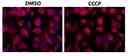 The fluorescence images of HeLa cells co-stained with Mitophagy Red&trade; and Hoechst 33342 (Cat#17535) in a 96-well black-wall clear-bottom plate. Image was acquired before (Left) and after (Right) addition of CCCP (10 uM) for 1 minute. The cells were imaged using a fluorescence microscope with a Cy3/TRITC filter.